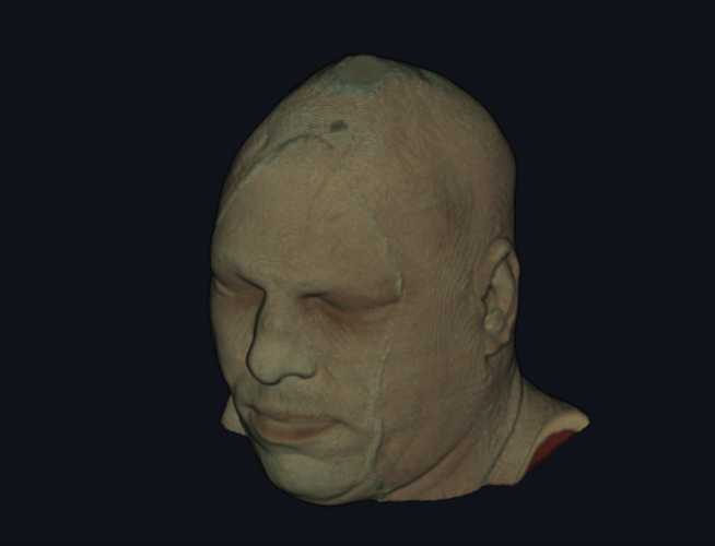 NiiVue Visible Human Rendering