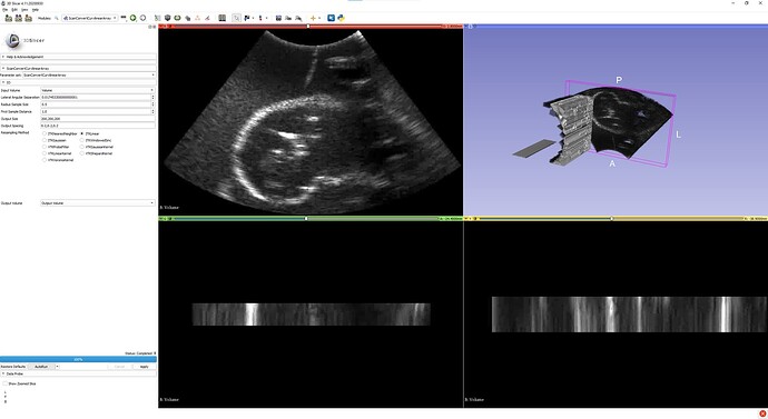 Image stack of ultrasound images and resampled volume using SlicerITKUltrasound