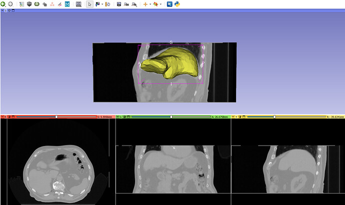 correctly_align_liver_mesh