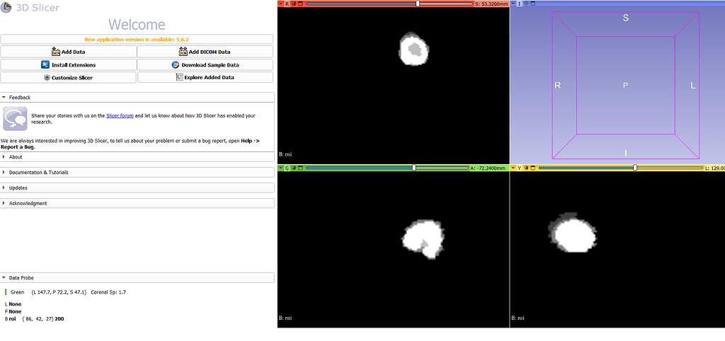 nii image not displaying with SimpleITK gui - python - ITK