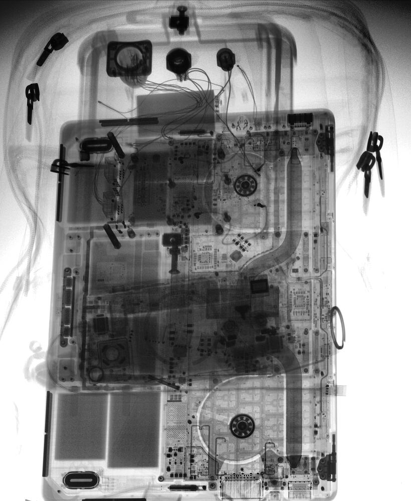 X-ray image file of TIFF format proces - Algorithms - ITK