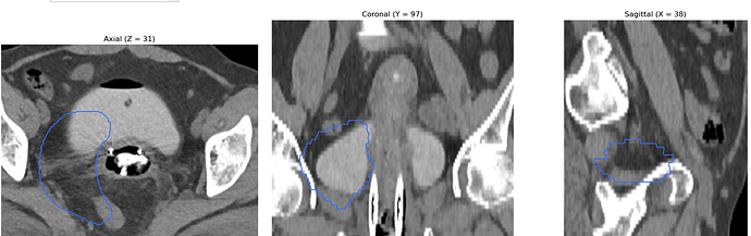 ct and rt structure