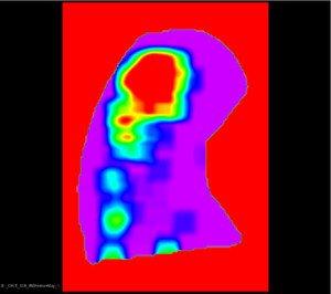 BoneMorphometry